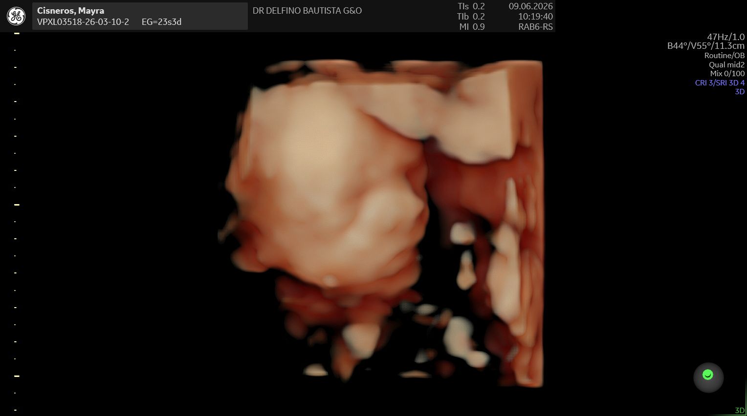 Ultrasonido 3D de Baby Cisneros