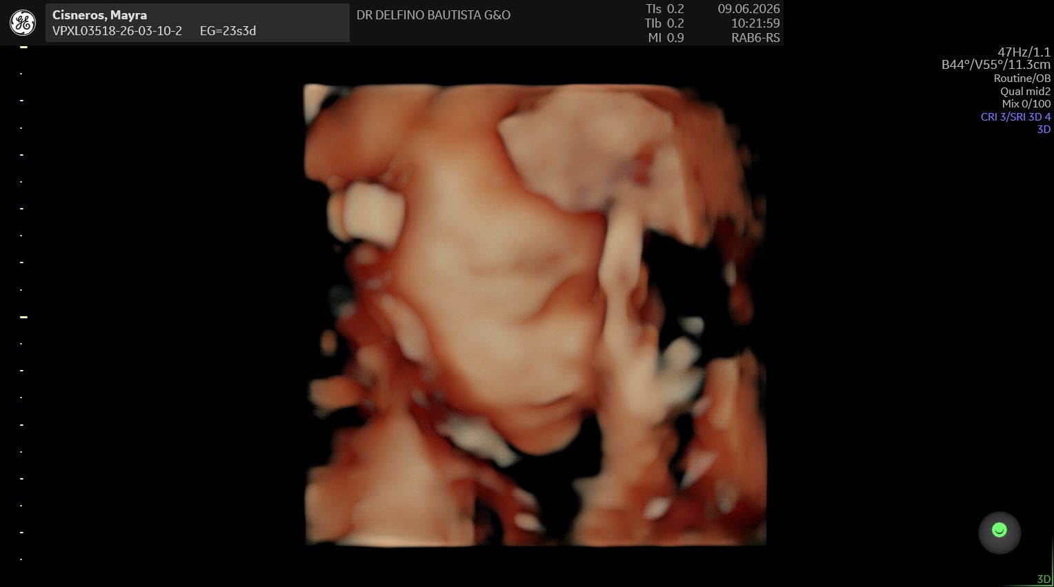Ultrasonido 3D de Baby Cisneros