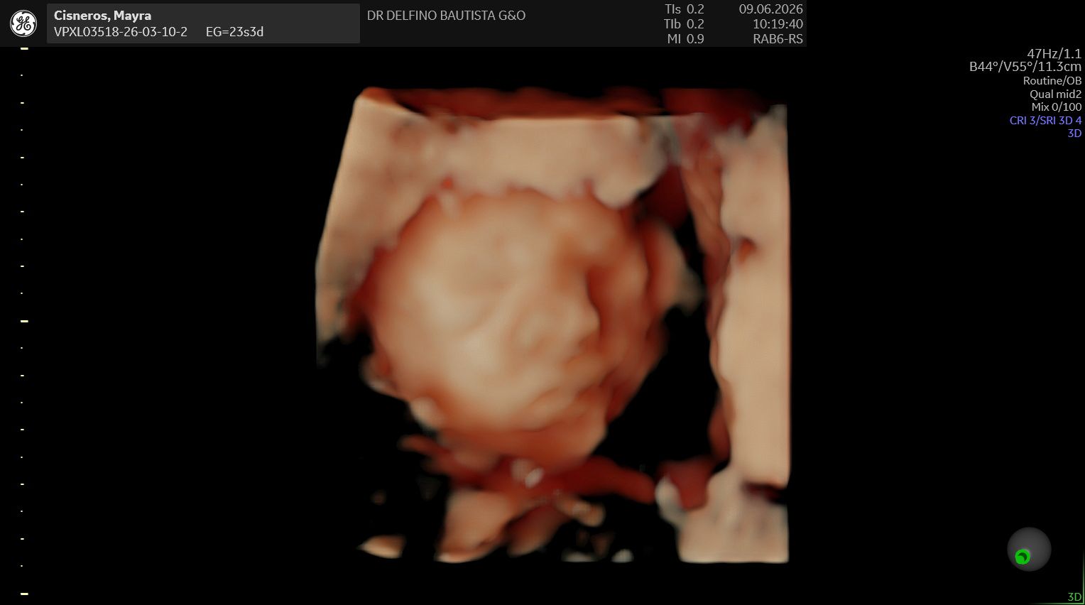 Ultrasonido 3D de Baby Cisneros
